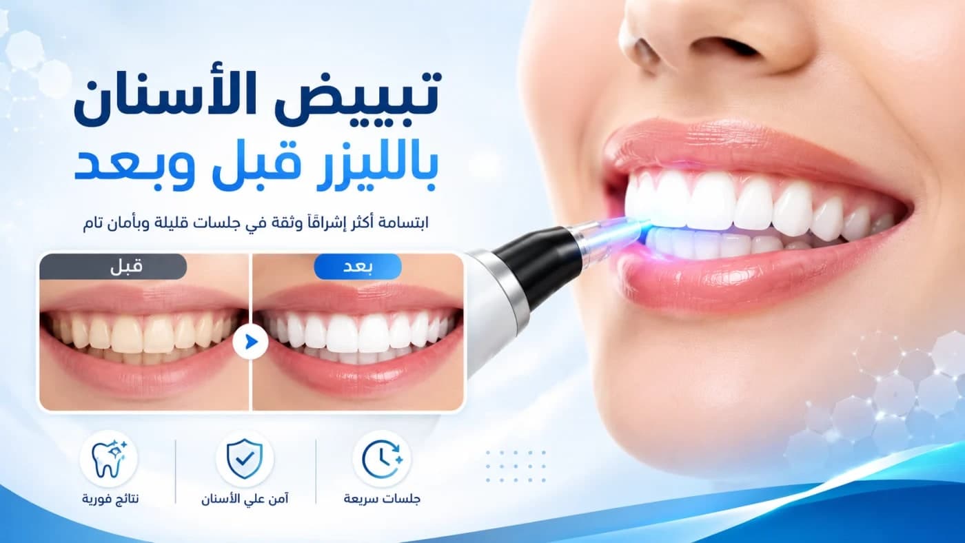 **Alt Text:**

تبييض الأسنان بالليزر مع عرض نتيجة قبل وبعد لإبراز الفرق في لون الأسنان وتحسين الابتسامة.