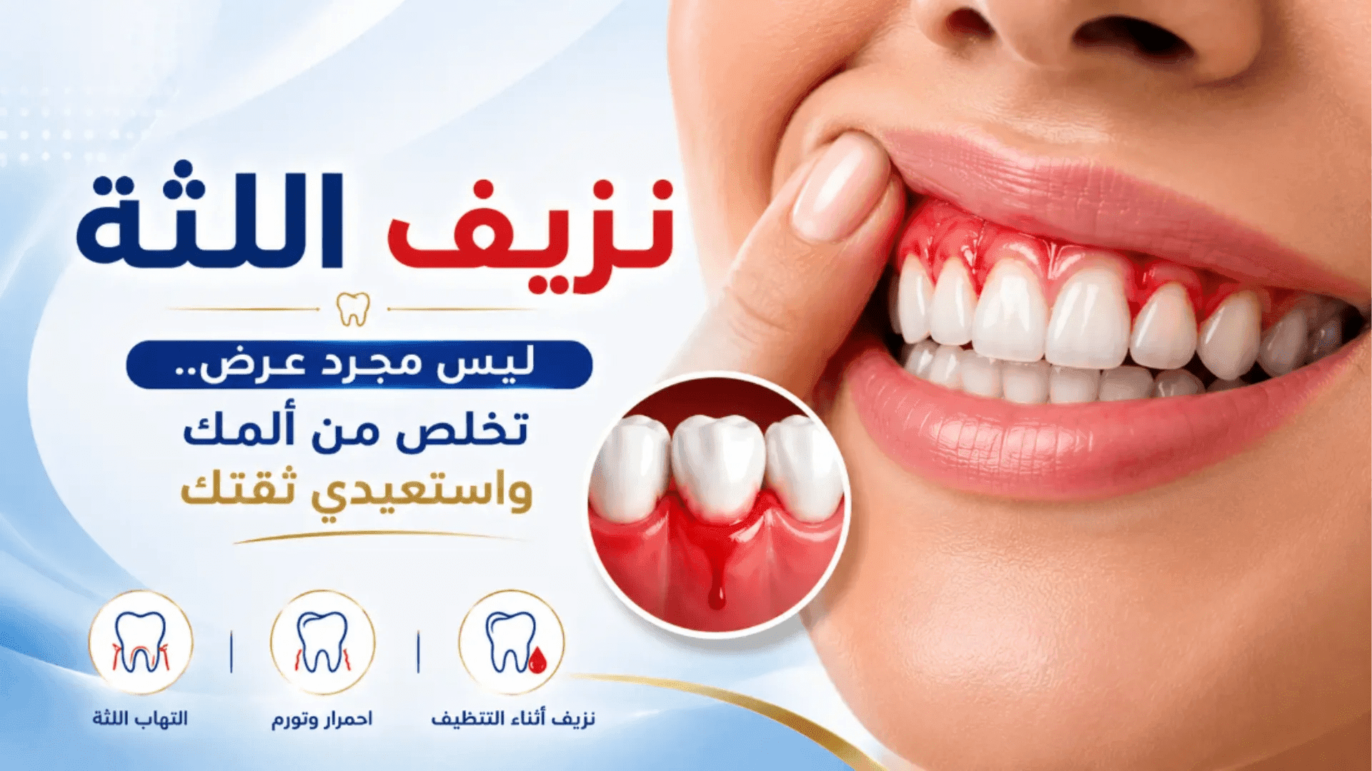 أعراض نزيف اللثة والتهاب اللثة مع توضيح أسباب النزيف أثناء تنظيف الأسنان وطرق العلاج