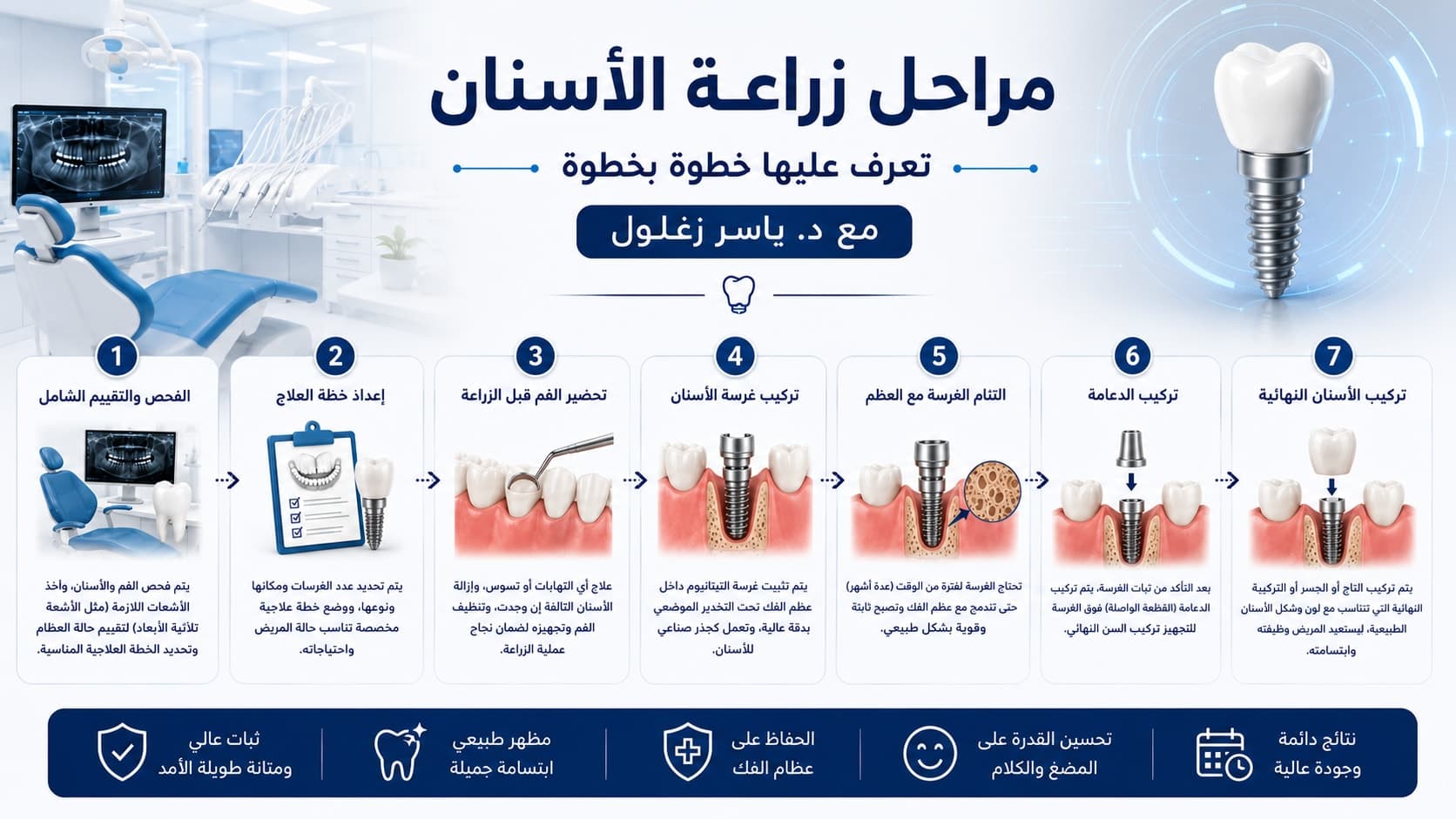 عيادة د. ياسر زغلول لطب الأسنان في مصر، وجهة السياحة العلاجية لابتسامة مثالية مراحل زراعة الأسنان بالتفصيل