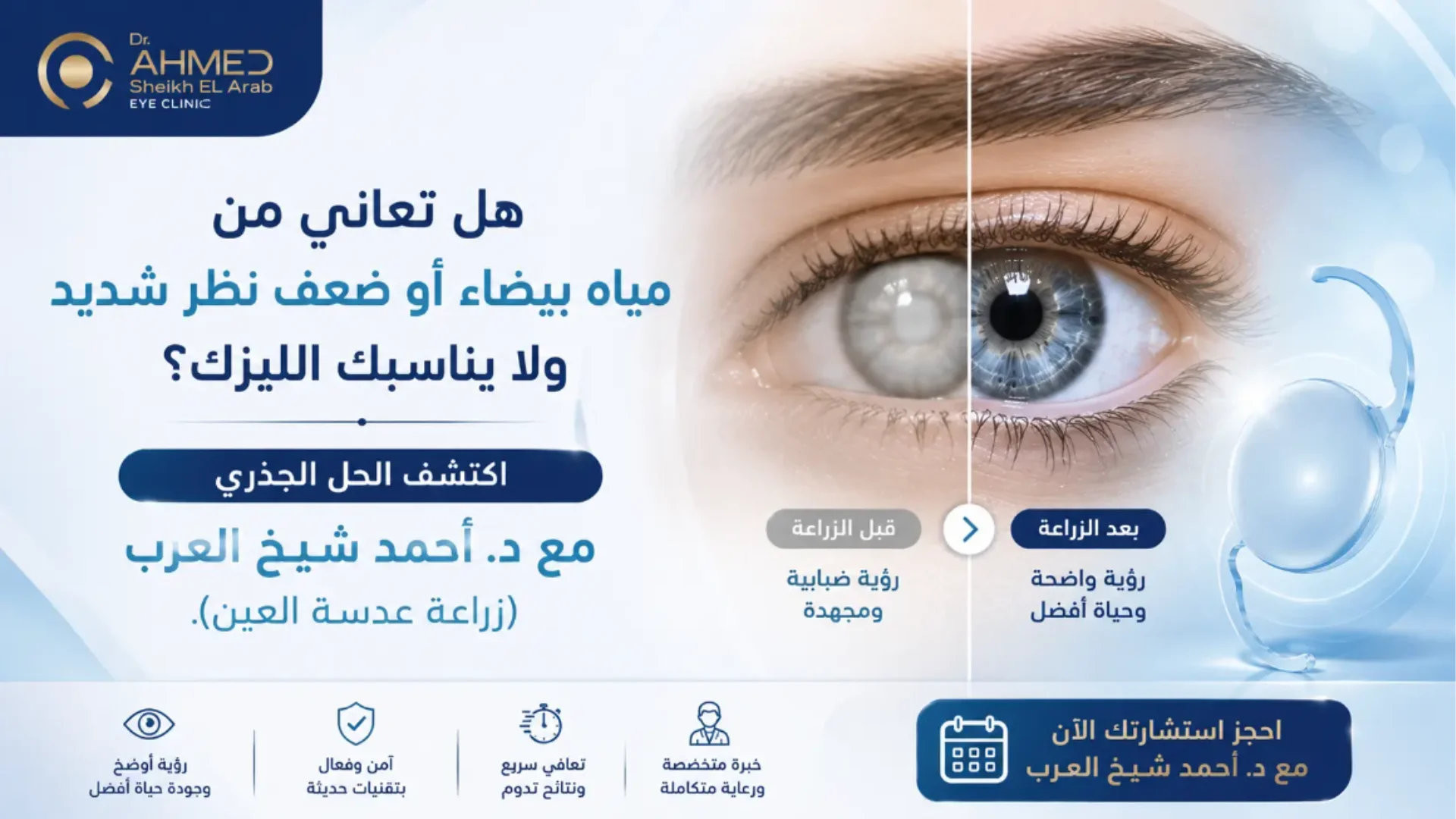 زراعة عدسة العين: الدليل الشامل من استشاري طب وجراحة العيون