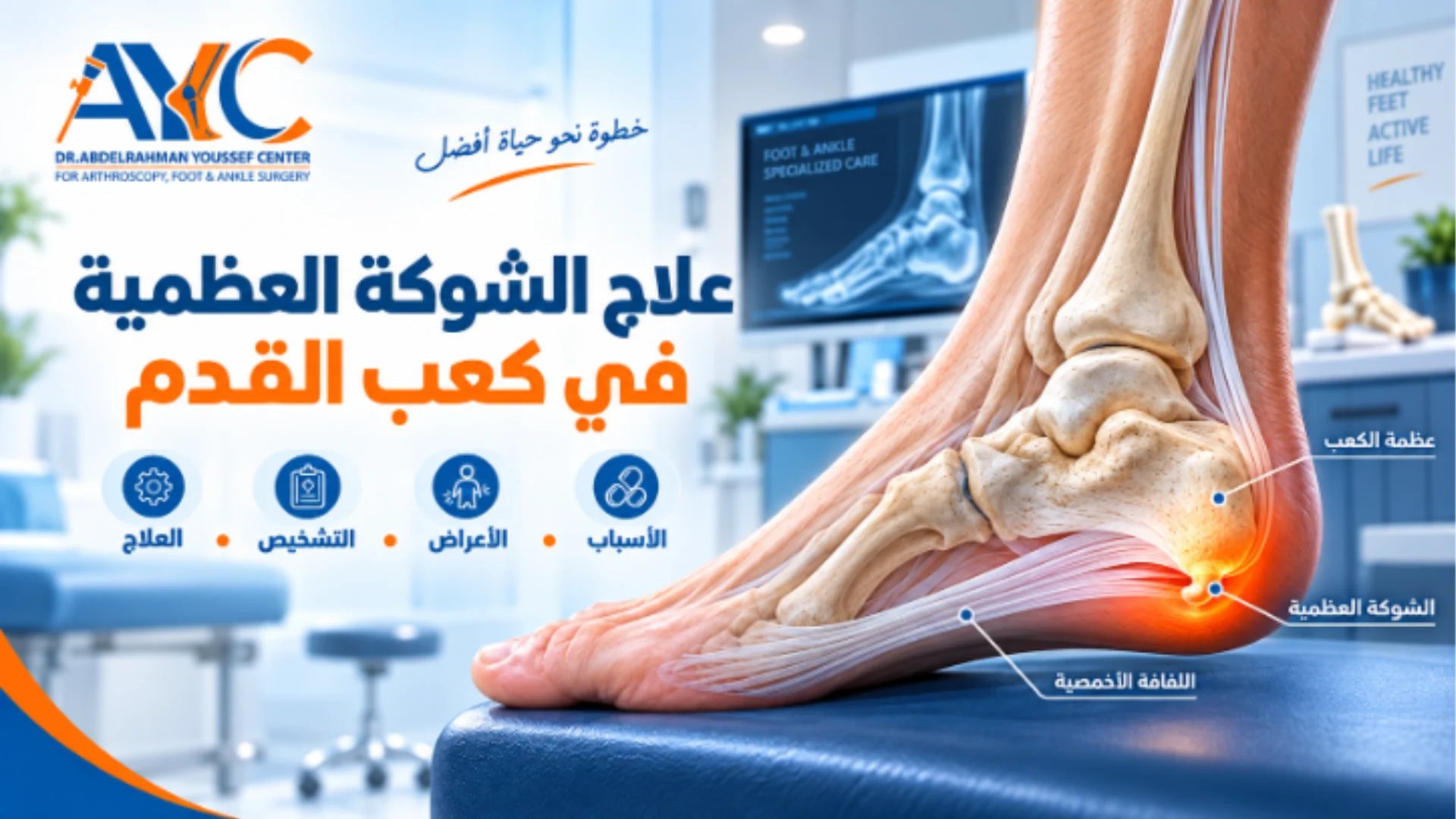 علاج الشوكة العظمية في كعب القدم: هل الشوكة هي سبب ألم الكعب؟
