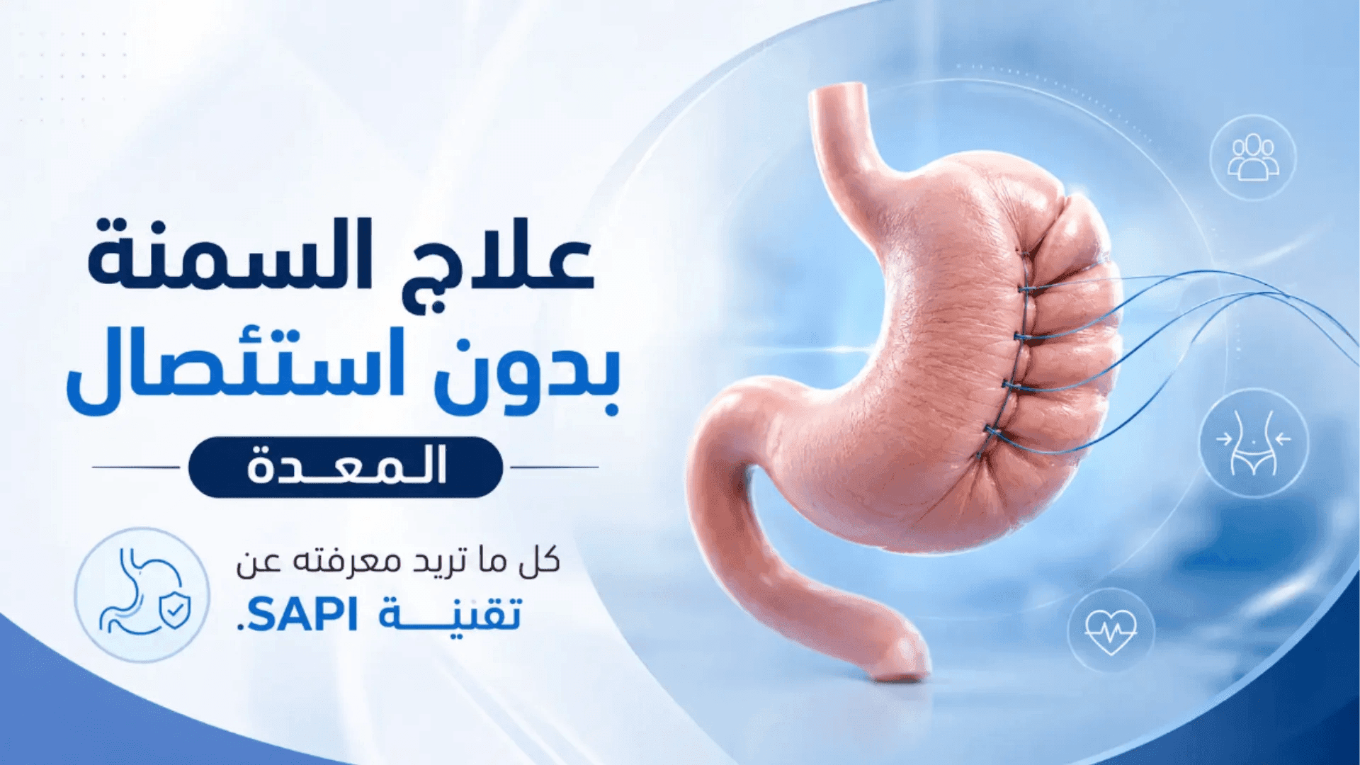 علاج السمنة بدون استئصال المعدة: الدليل الشامل لتقنية SAPI