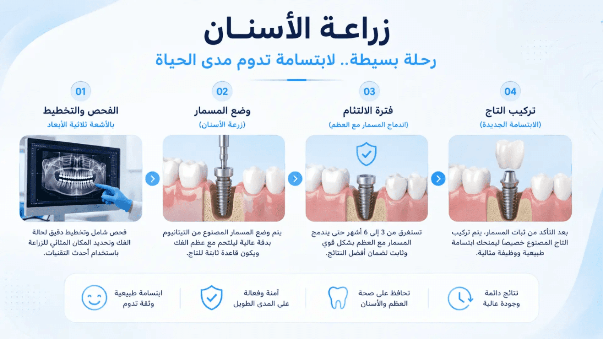 مراحل زراعة الأسنان من الفحص والتخطيط حتى تركيب التاج النهائي واستعادة الابتسامة