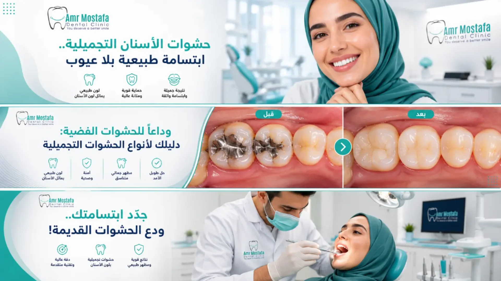 حشوات الأسنان التجميلية: كل ما تحتاج معرفته لابتسامة واثقة