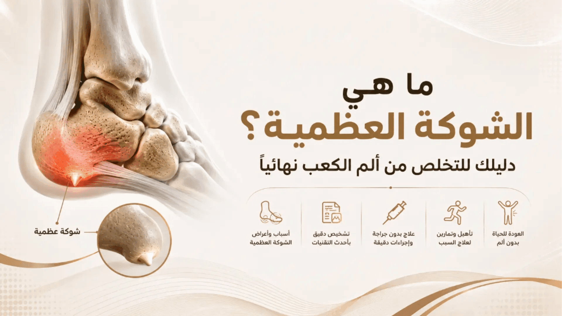 ما هى الشوكة العظمية؟ دليلك للتخلص من ألم الكعب نهائياً