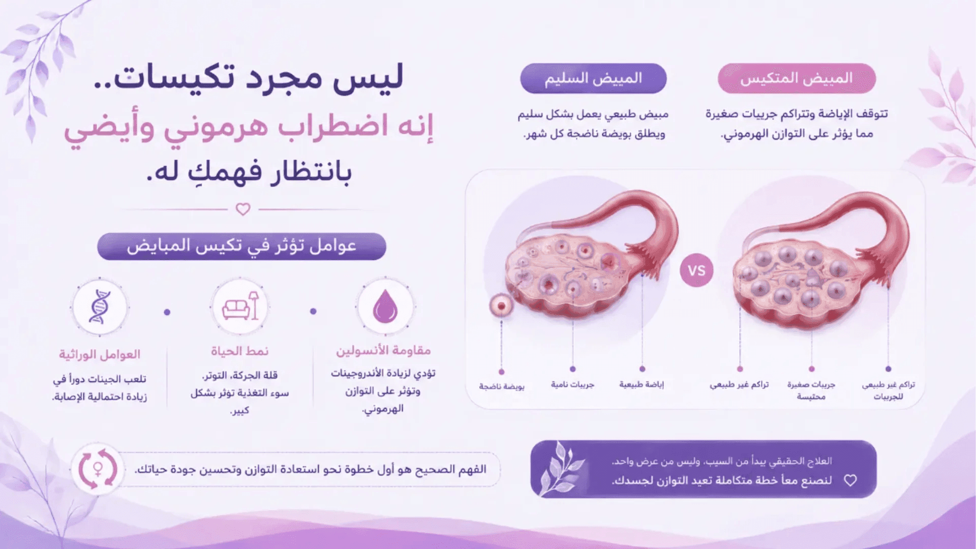 مقارنة بين المبيض السليم والمبيض المصاب بتكيس المبايض مع شرح أسباب وأعراض متلازمة تكيس المبايض.