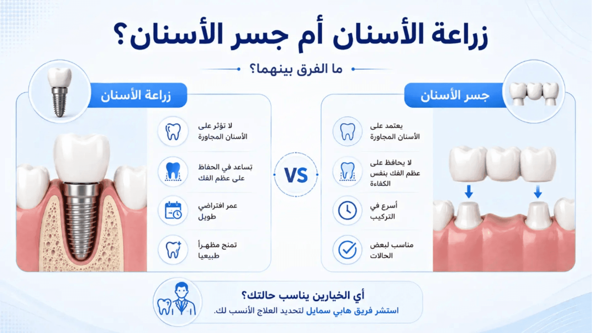 تعرف علي الفرق بين زراعة الاسنان وجسر الأسنان لأختيار الأفضل